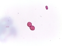 Aesculus parviflora – Bottlebrush Buckeye