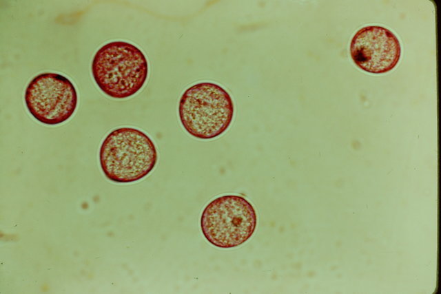 Anemone_tomentosa,_pollen,I_POL522