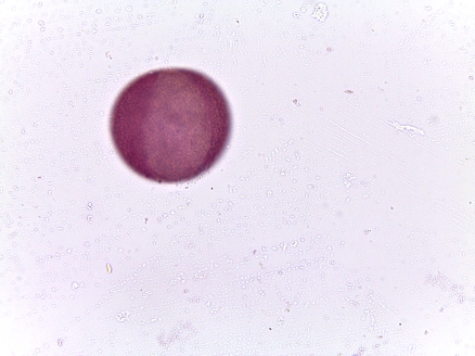 Asphodelus luteus–Yellow Asphodel