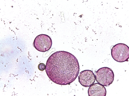 Lythrum salicaria–Purple Loosetrife