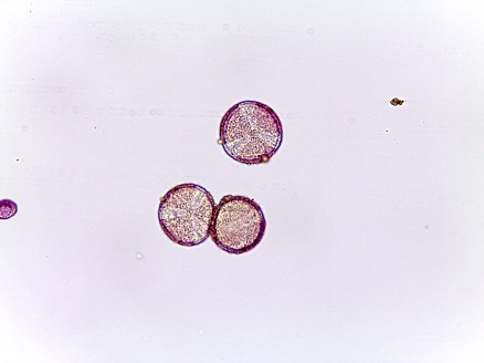 Ranunculus spp. – Buttercup